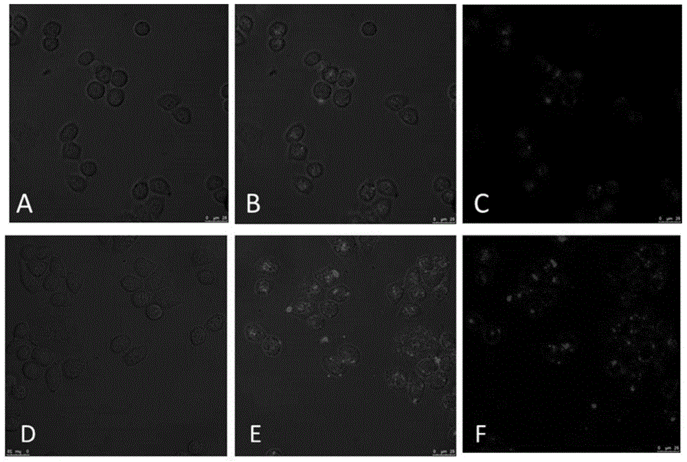 Targeted EGFR (epidermal growth factor receptor) modified platinum drug supported albumin nanoparticle as well as preparation and application thereof