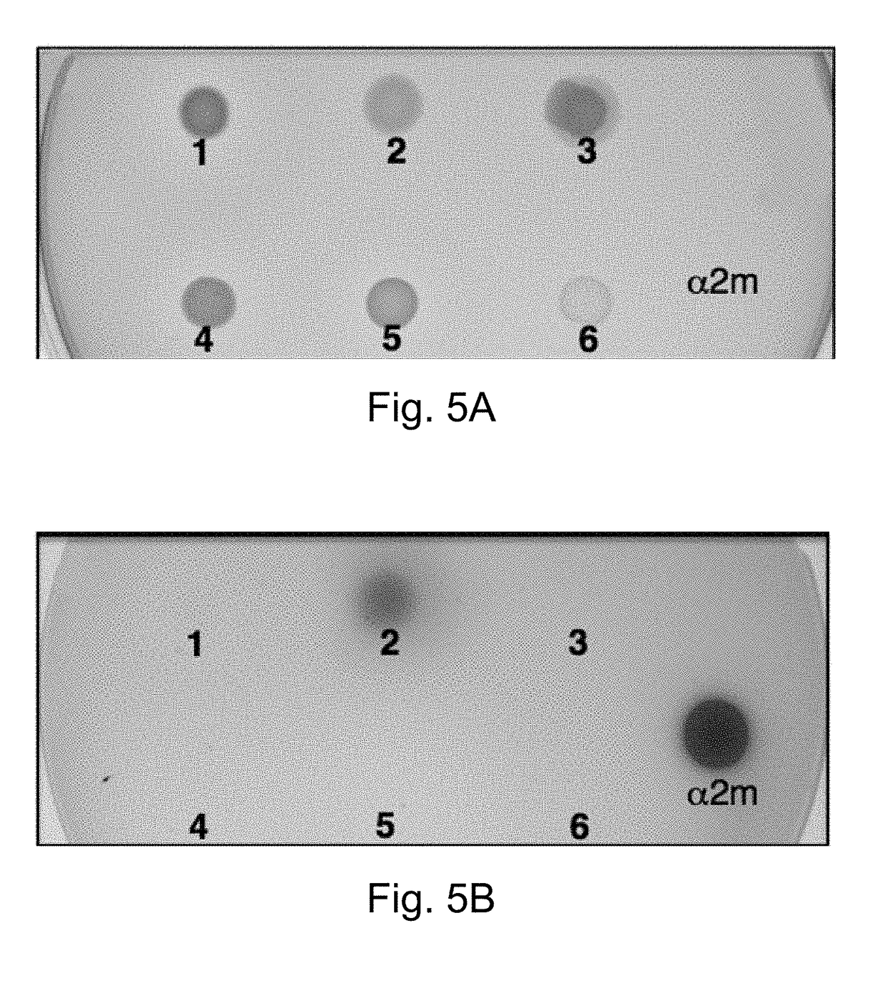 Topical and orally administered protease inhibitors and bacterial vectors for the treatment of disorders and methods of treatment
