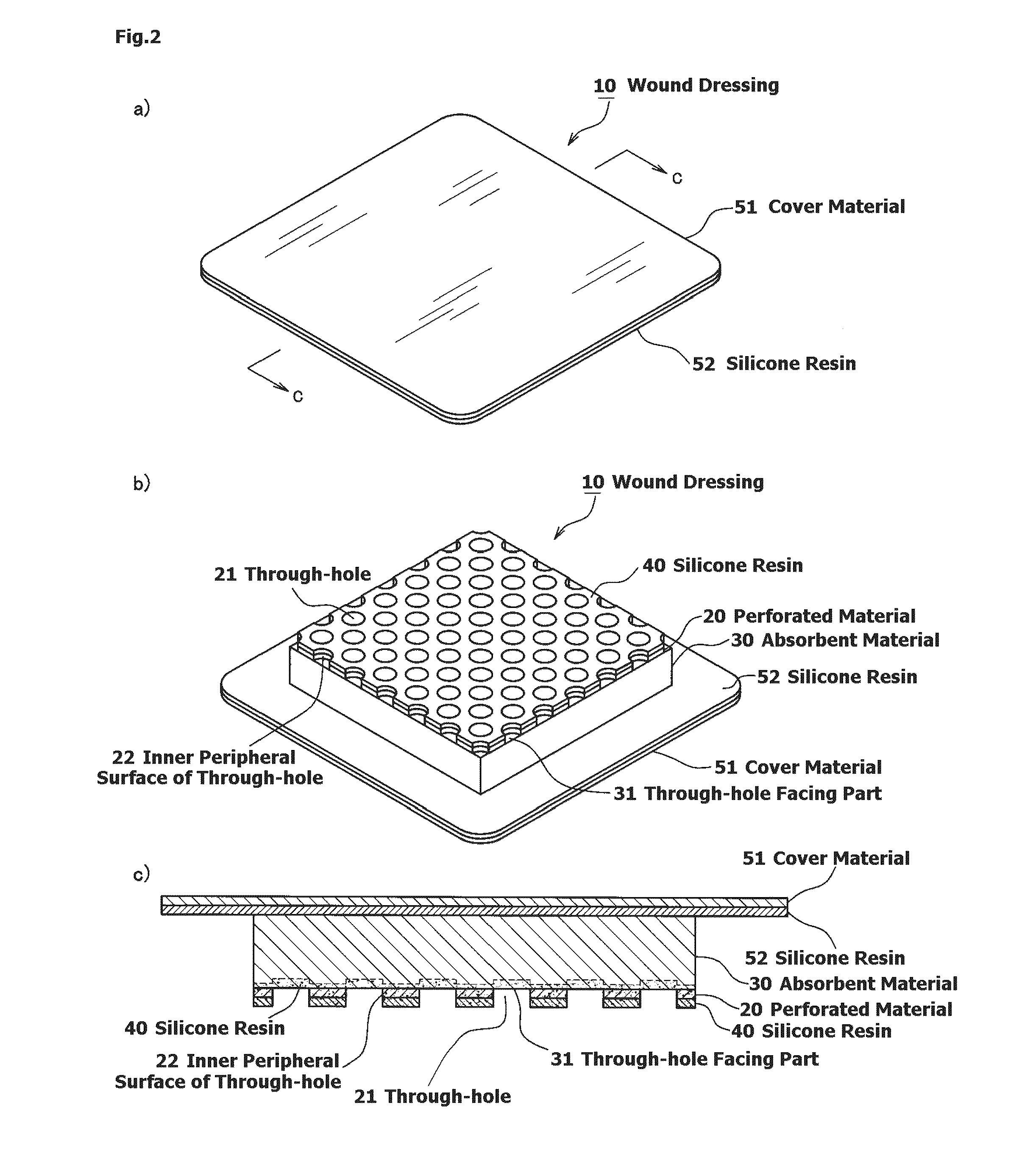 Wound dressing and method for producing it