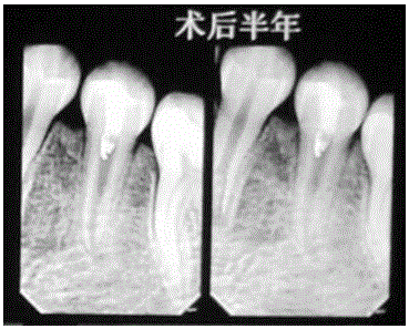 Inflammation-diminishing paste for dental pulp, and preparation method of inflammation-diminishing paste
