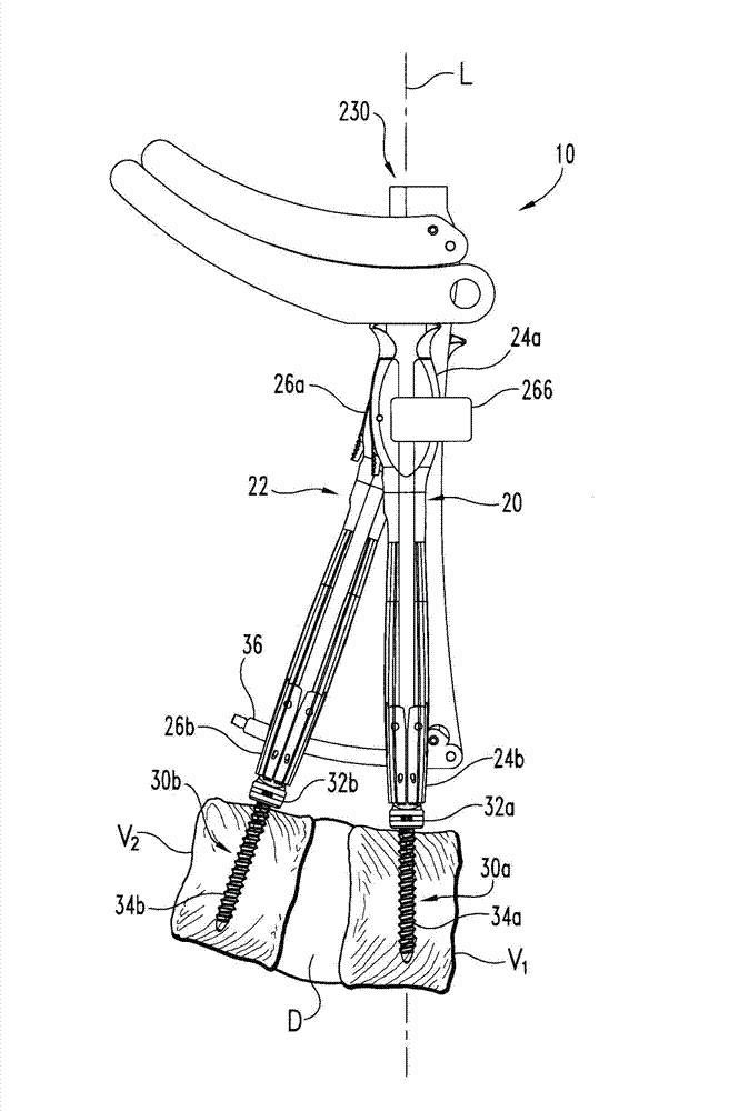 Systems and methods for minimally invasive surgical procedures