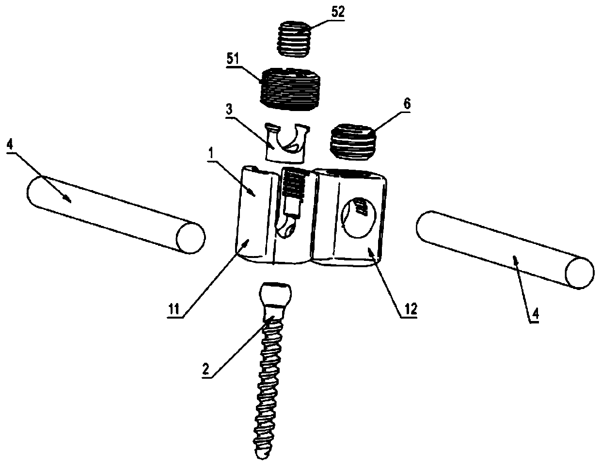 Double-headed base multi-angle plane adjustment intraspinal fixation system