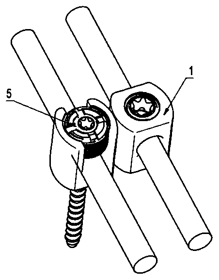 Double-headed base multi-angle plane adjustment intraspinal fixation system