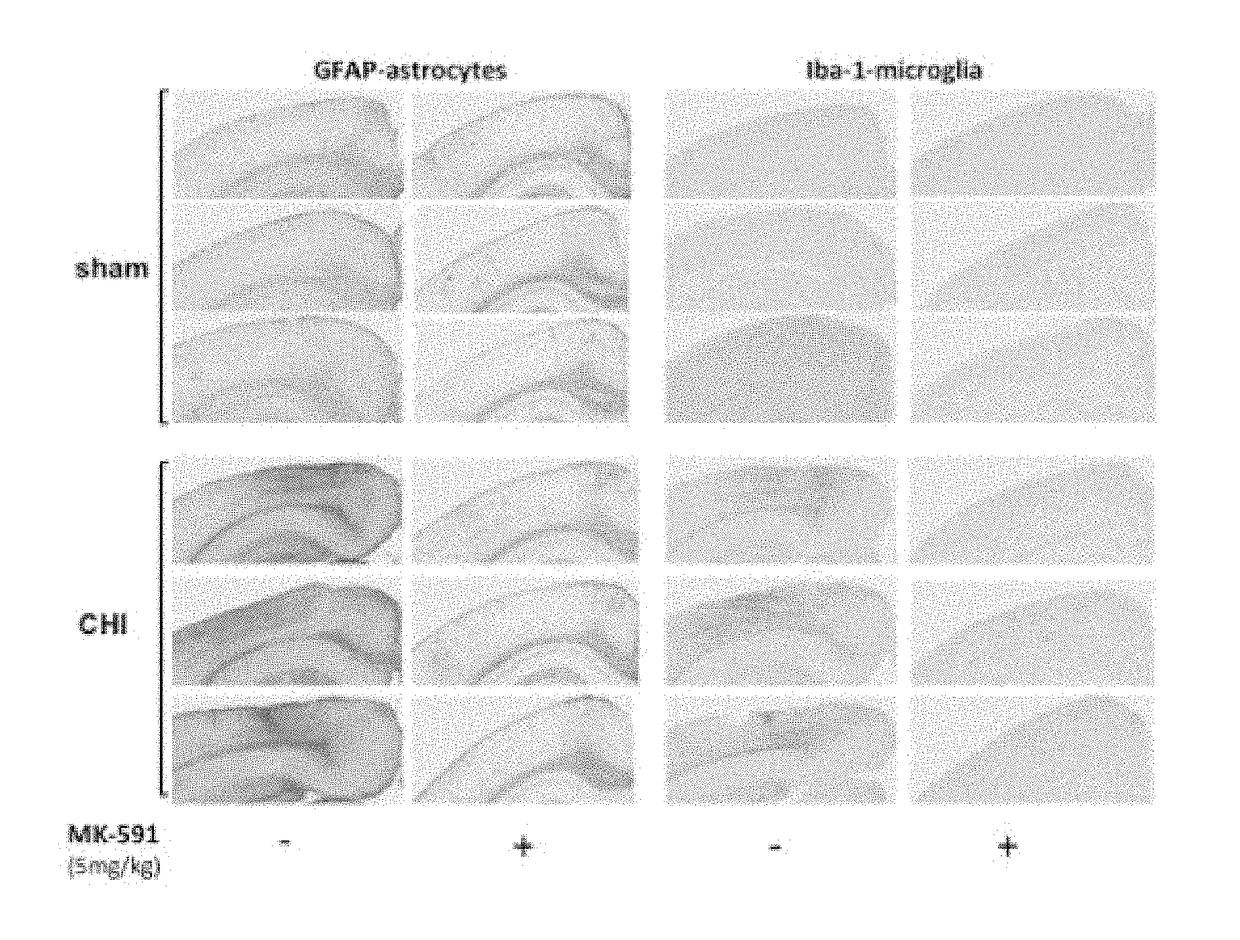 Use of flap inhibitors to reduce neuroinflammation mediated injury in the central nervous system