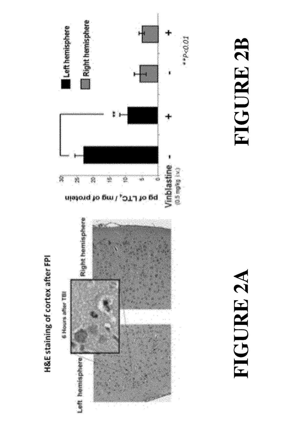 Use of flap inhibitors to reduce neuroinflammation mediated injury in the central nervous system