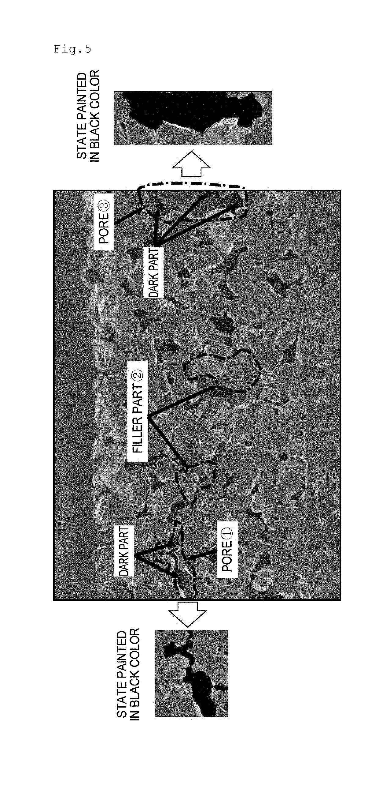Separator including polyolefin microporous membrane and inorganic porous layer, and nonaqueous electrolyte battery using the same