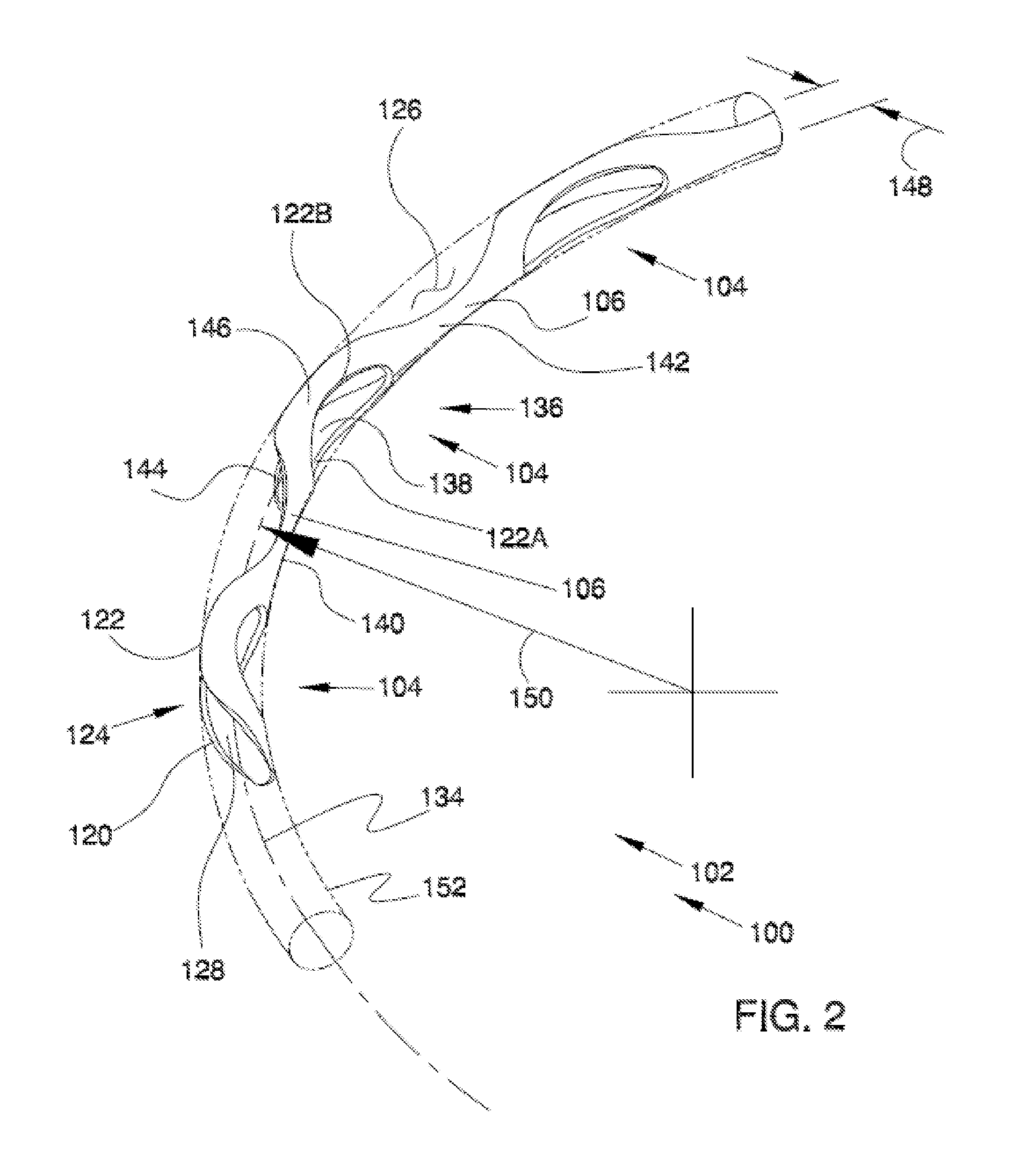 Methods and devices for increasing aqueous humor outflow