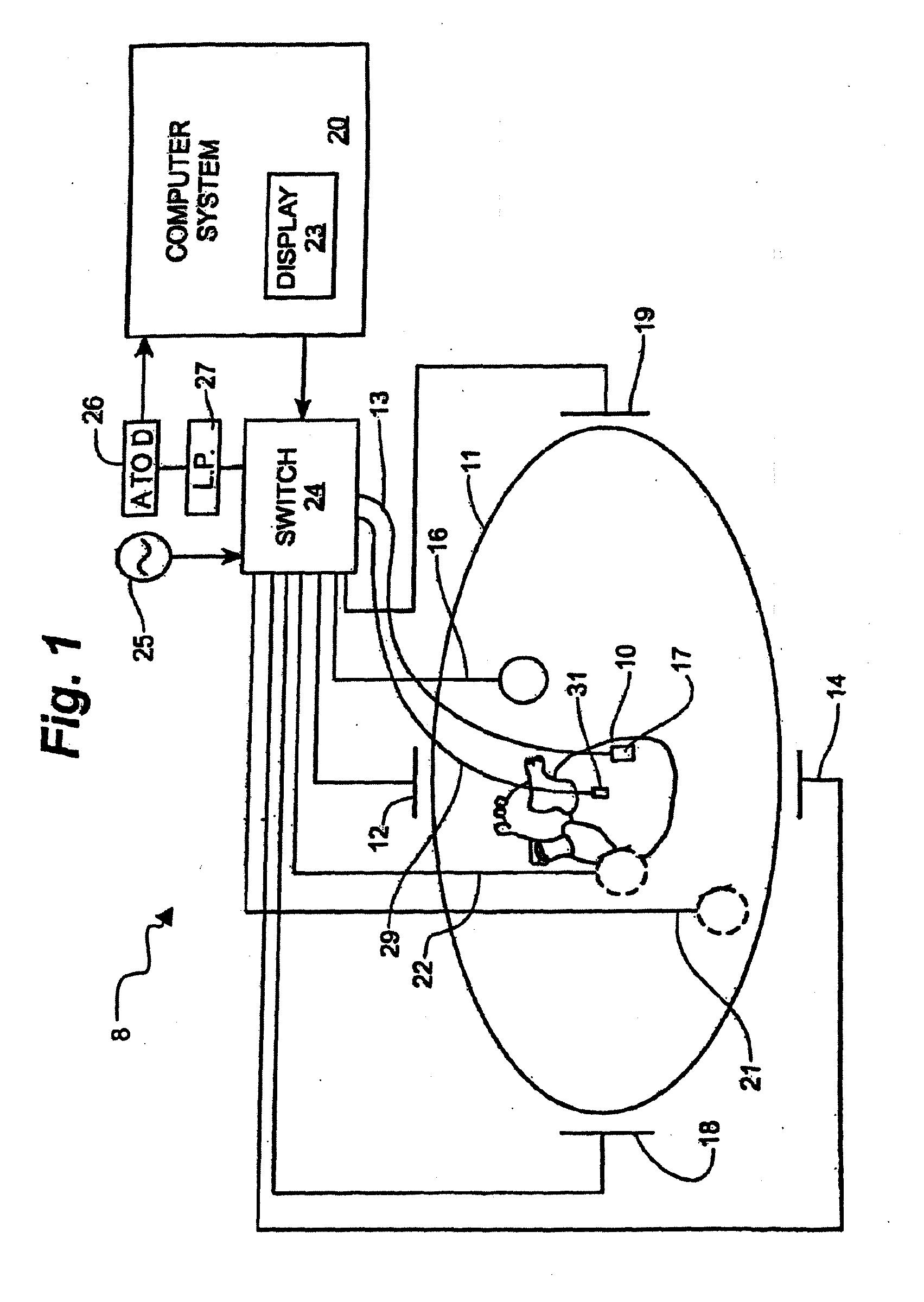 Apparatus and method for positioning and retention of catheter