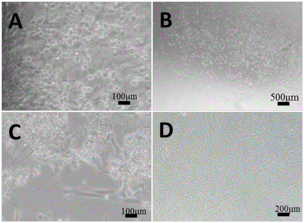 Improved separation preparation method for mouse thoracic aorta vascular smooth muscle cells