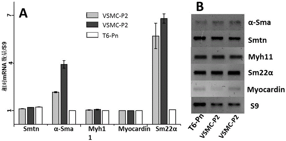 Improved separation preparation method for mouse thoracic aorta vascular smooth muscle cells