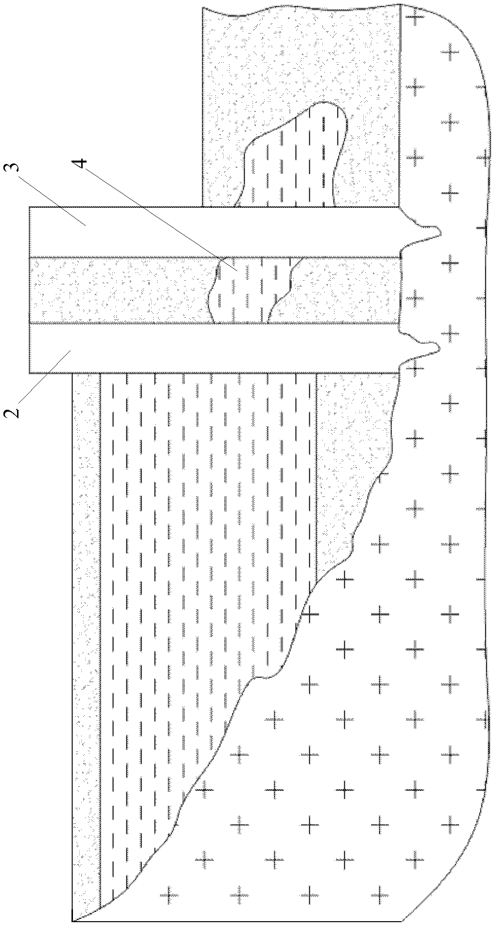 Leaking stoppage method for foundation pit