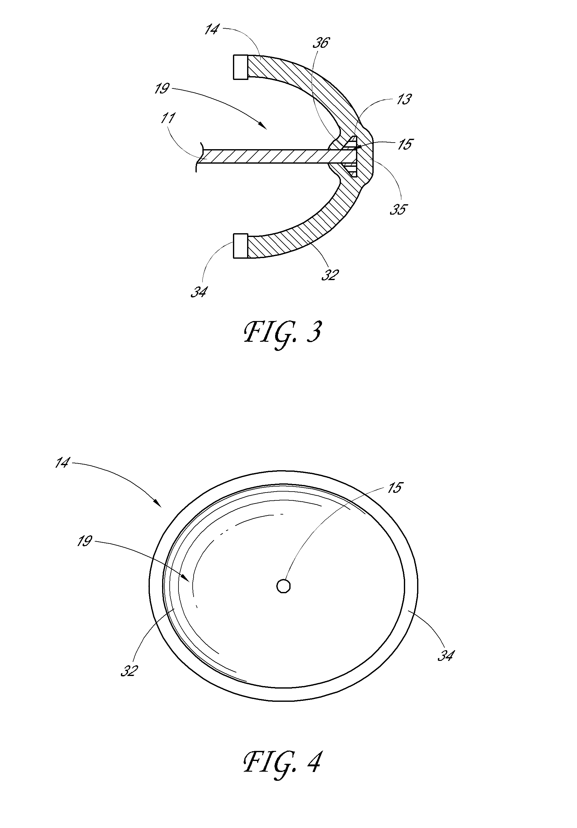 Device and method for assisting end-to-side anastomosis