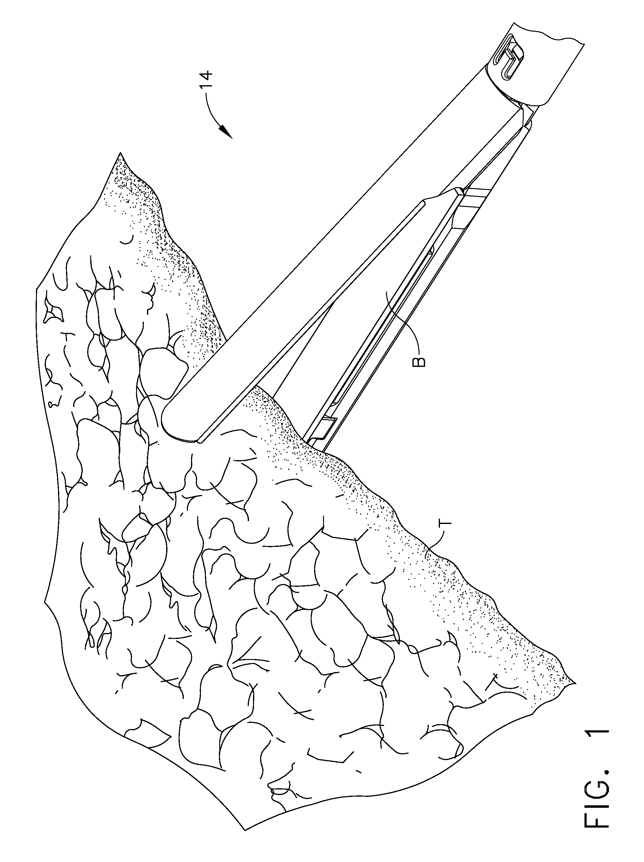 Packaging for attaching buttress material to a surgical stapling instrument