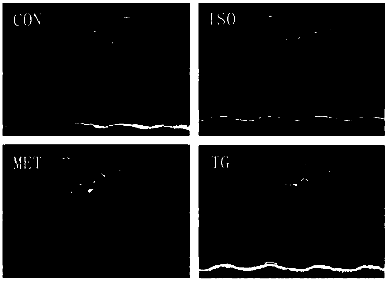 Application of Tongguan capsule to preparation of drug for treating hypertensive heart failure