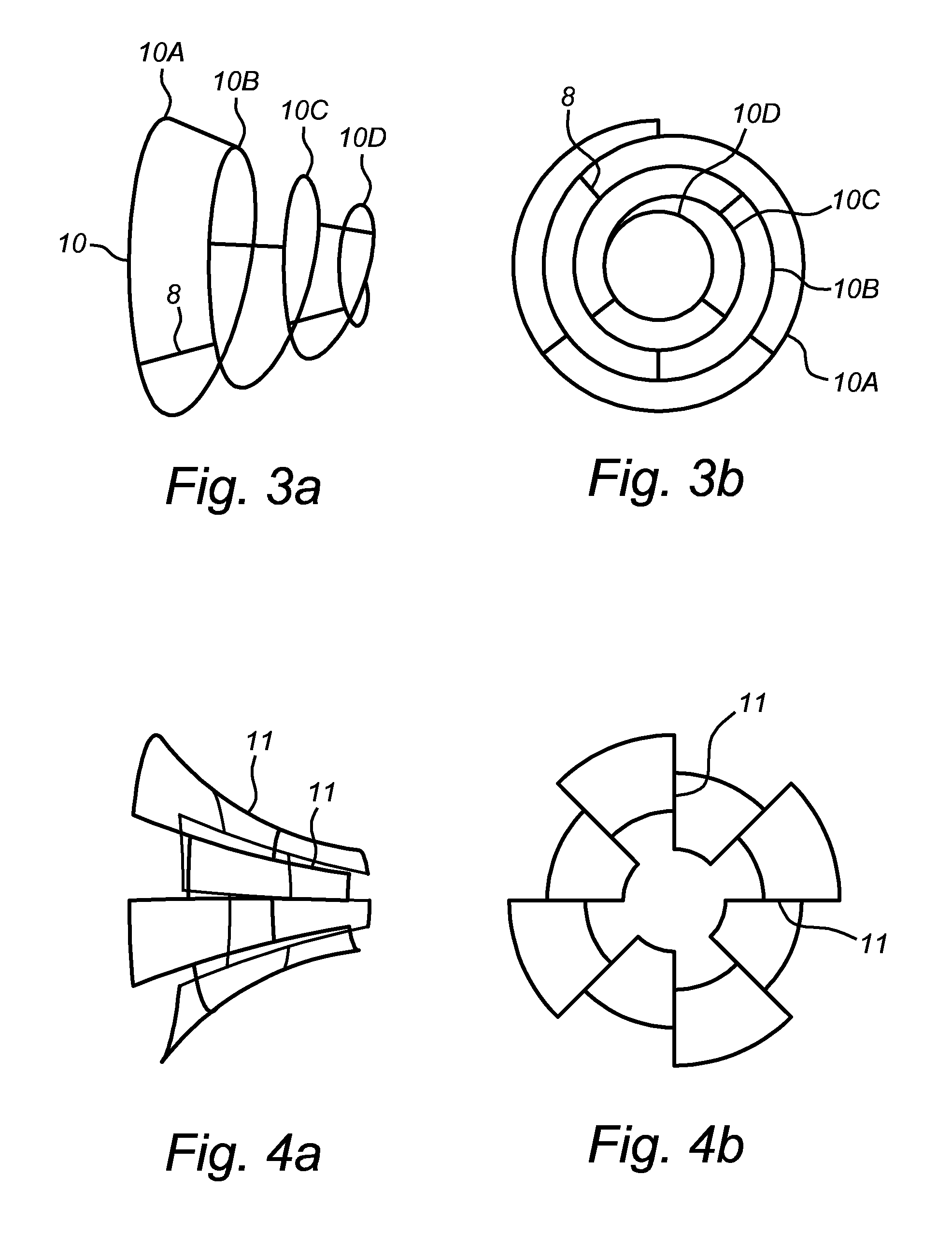 System, device and method for ablation of a vessel's wall from the inside