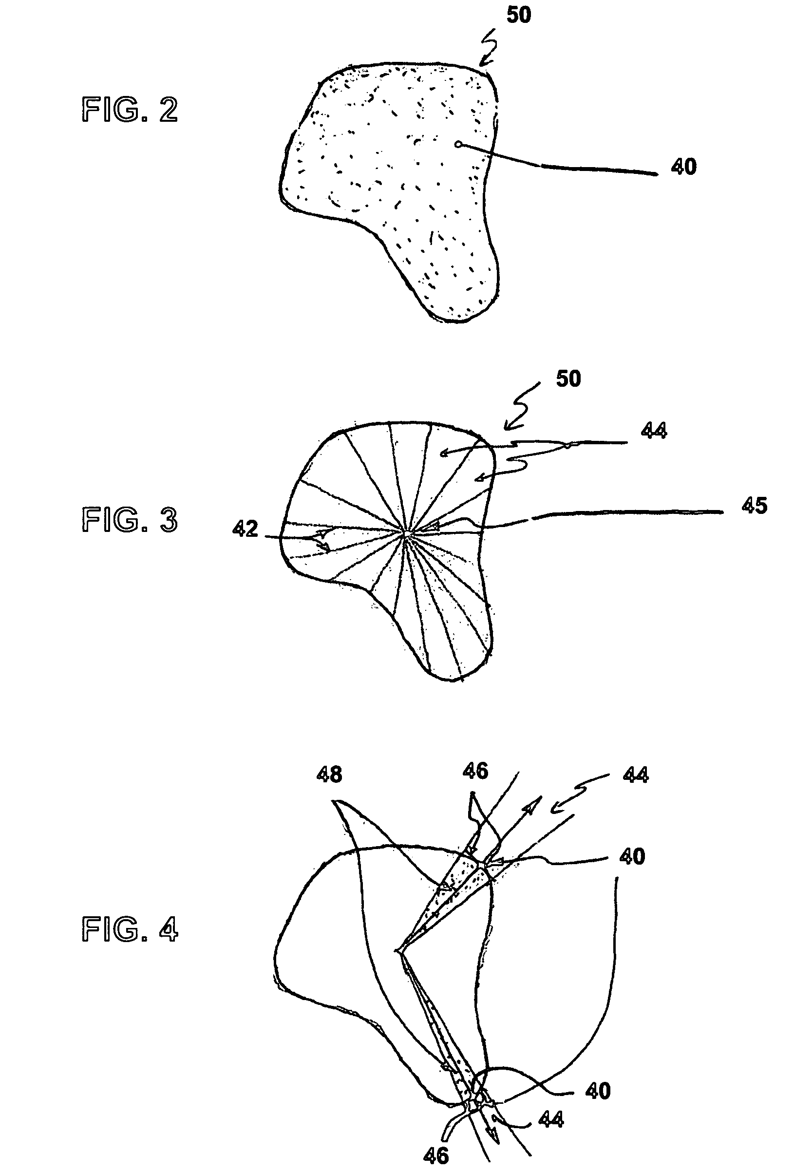 System and method for complex geometry modeling of anatomy using multiple surface models