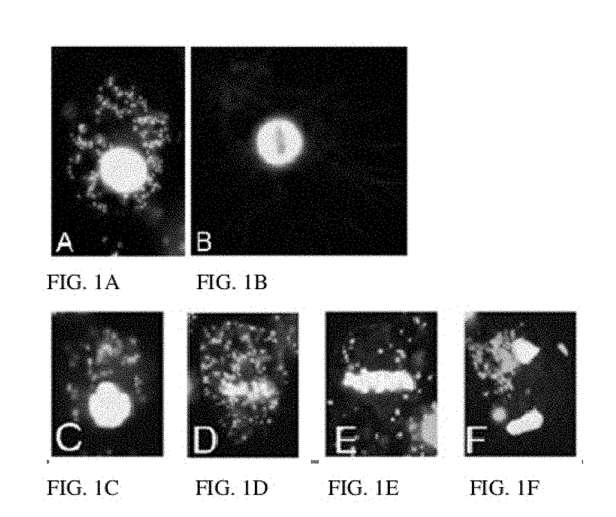 Compositions and Methods employing Wolbachia FtsZ as a target for Albendazole sulfone