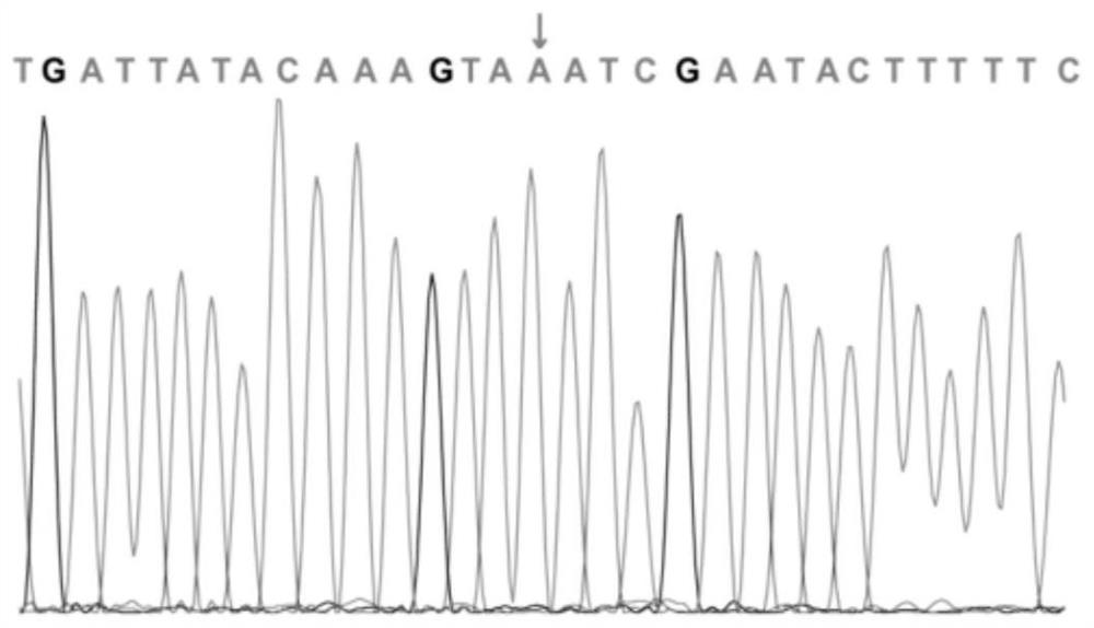 A kind of intellectual disability disease-related atrx gene mutation site and detection kit