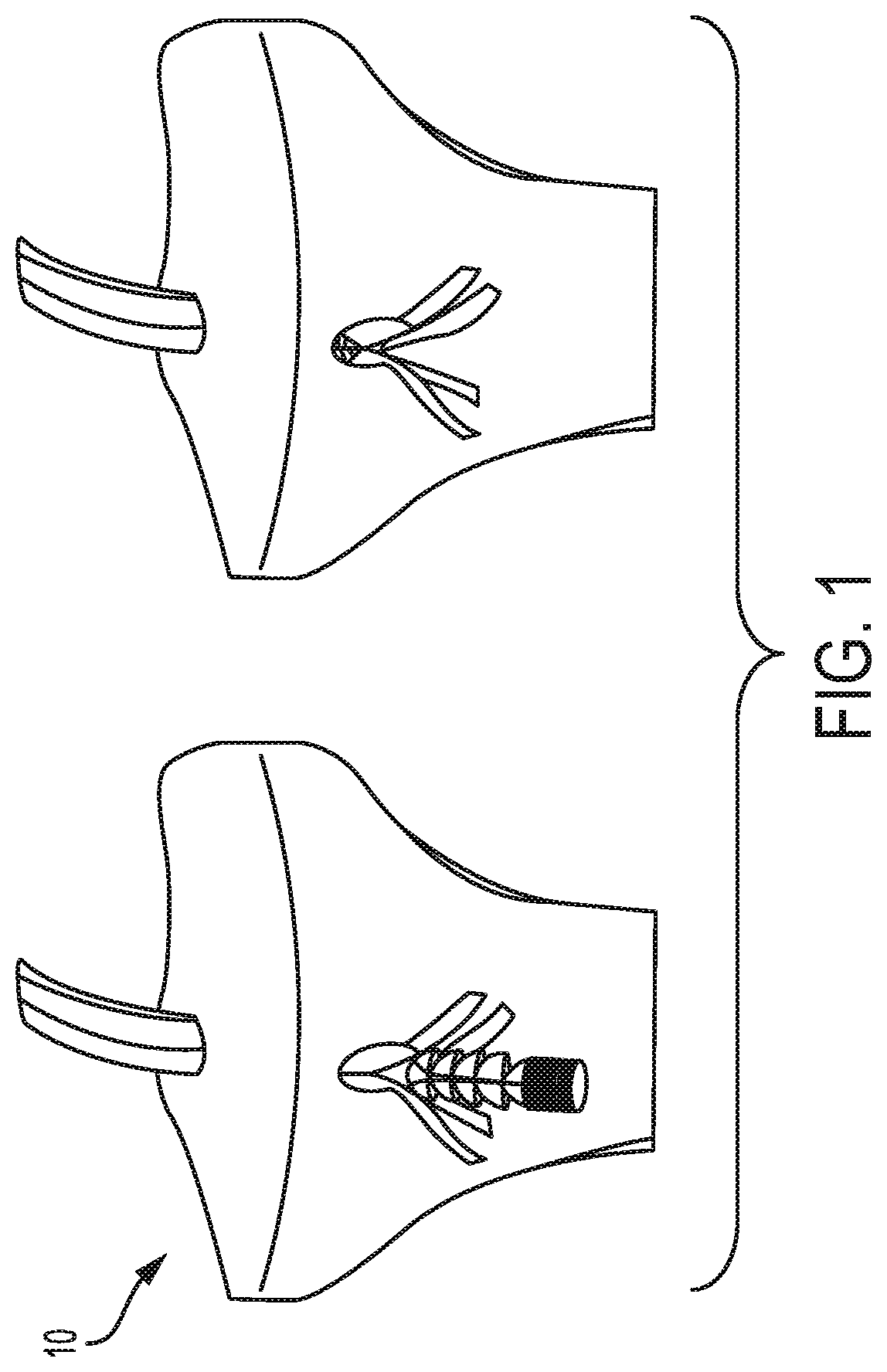 Expanding anchor