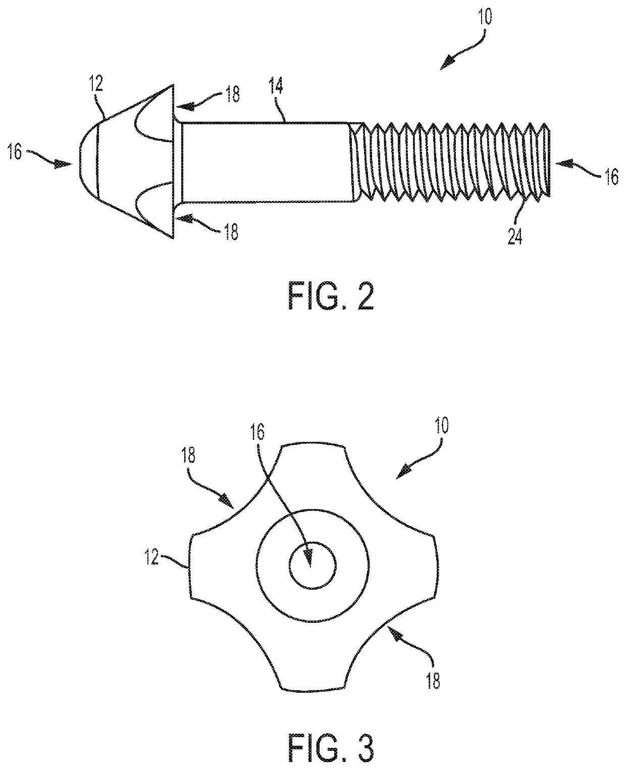 Expanding anchor