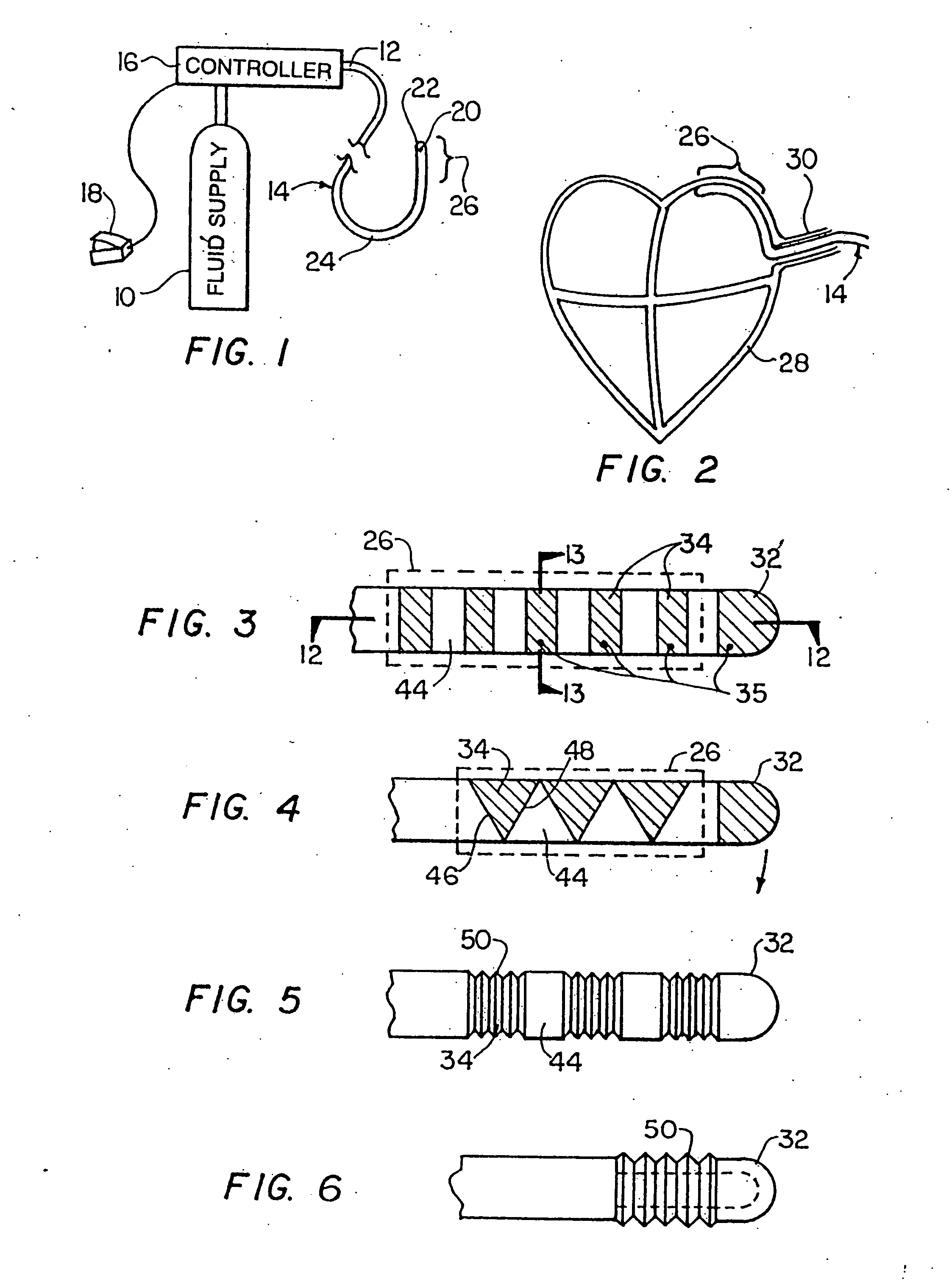 Method and device for epicardial ablation