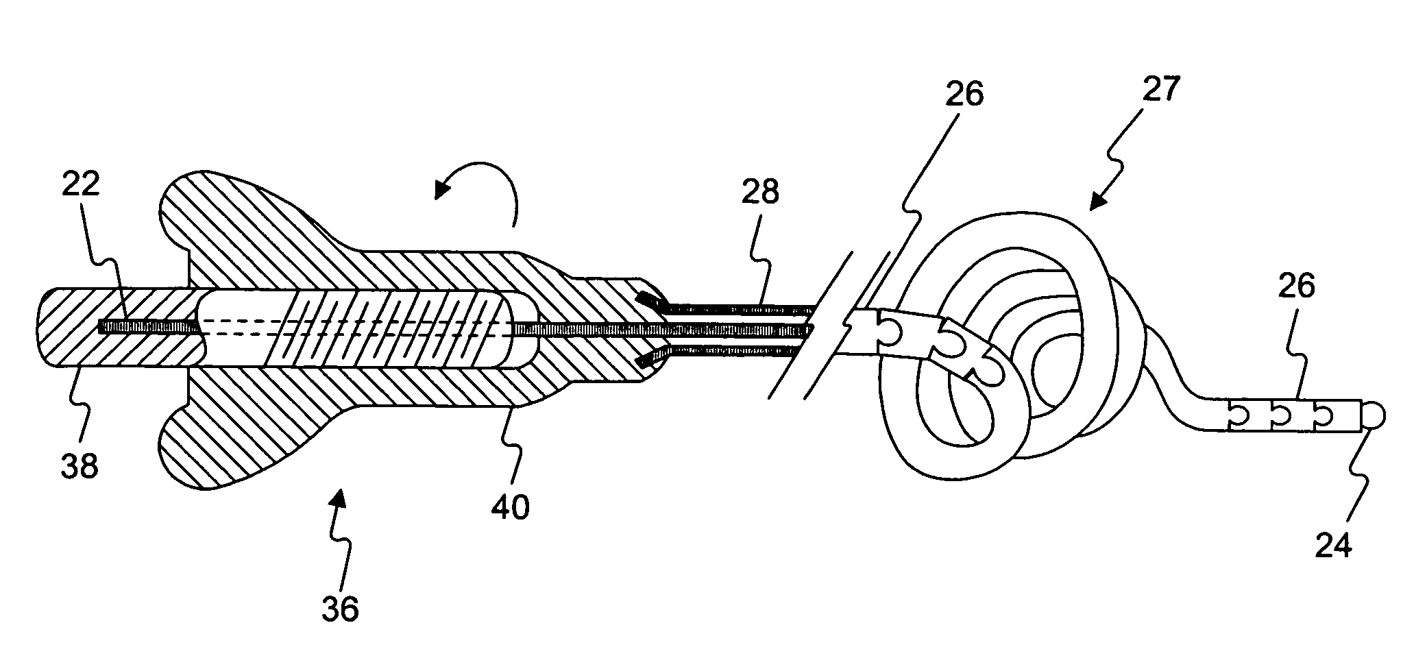 medical-retrieval-device-and-related-methods-of-use-eureka-patsnap