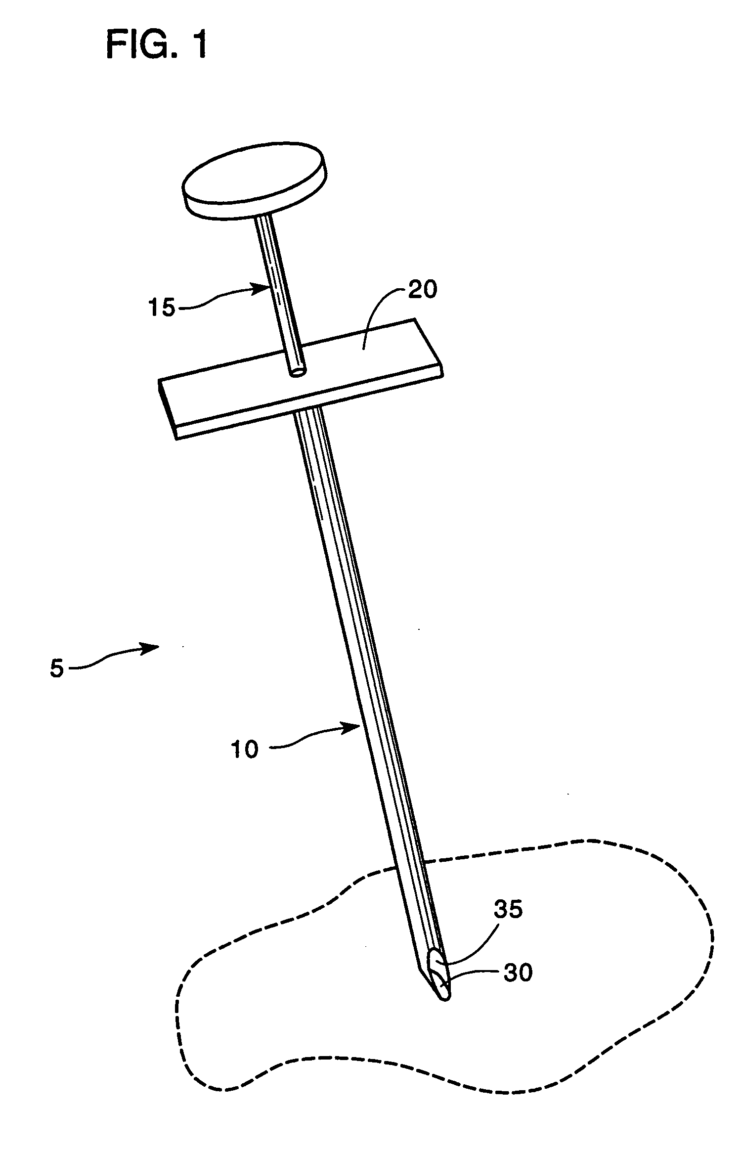 Apparatus and method for placing suture wires into tissue for the approximation and tensioning of tissue