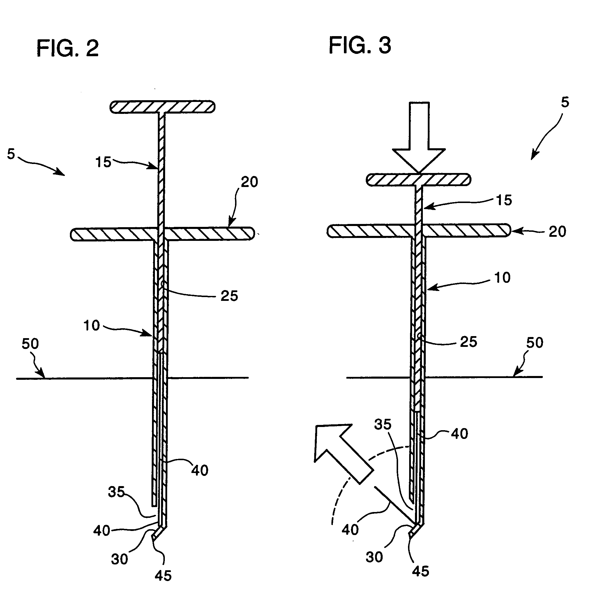 Apparatus and method for placing suture wires into tissue for the approximation and tensioning of tissue