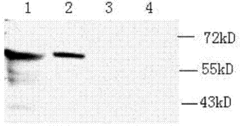 Clostridium difficile exotoxin B amino-terminal gene sequence with optimized codon and nucleic vaccine of clostridium difficile exotoxin B