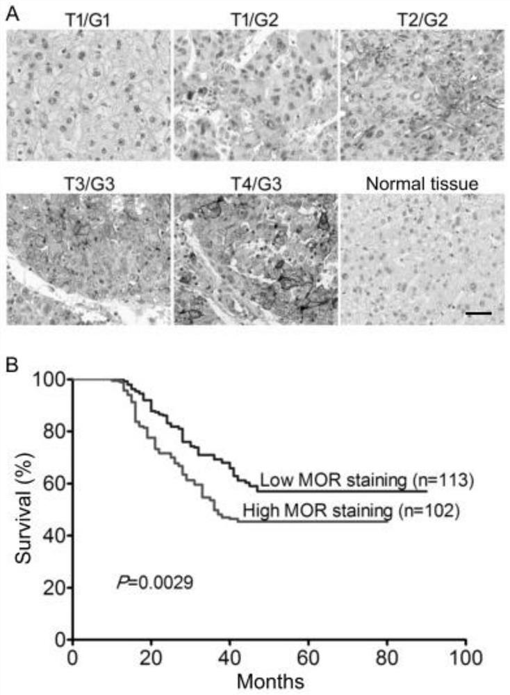 MOR detection kit