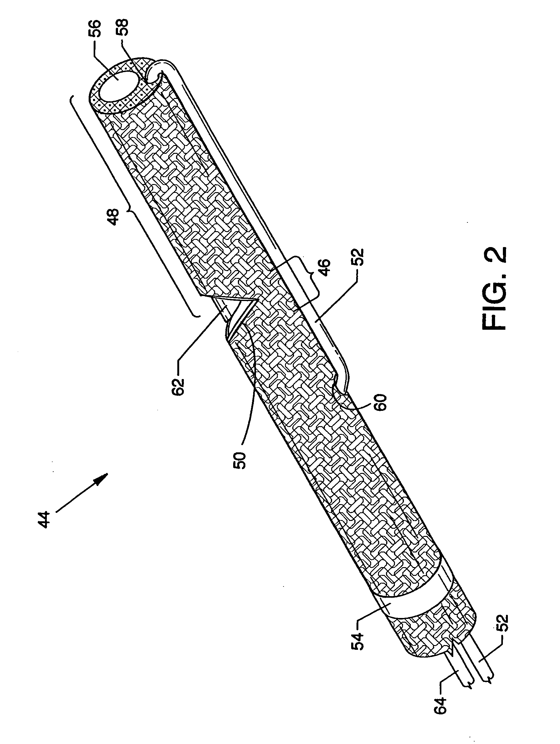 Atherectomy system having a variably exposed cutter