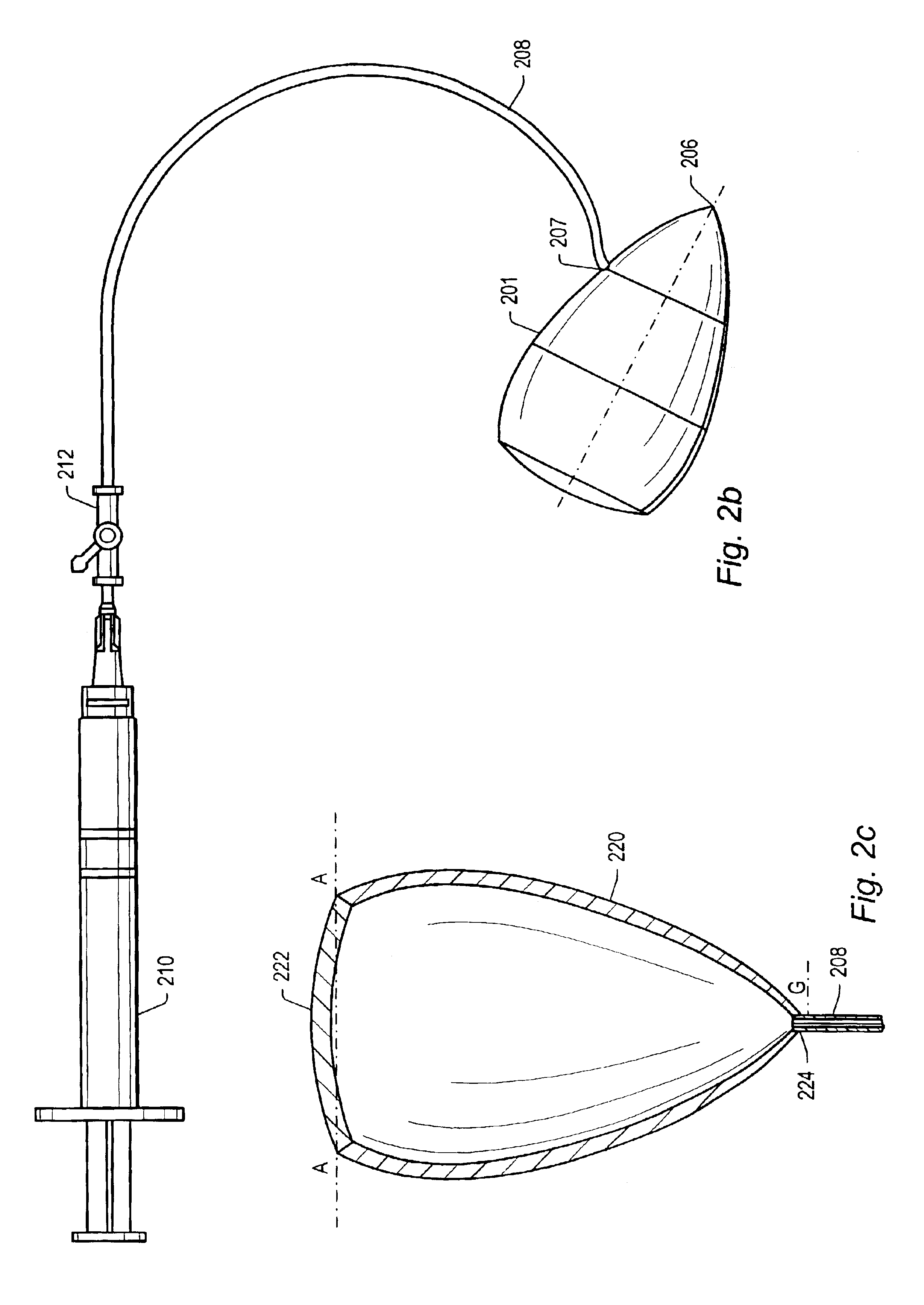 Kit and method for use during ventricular restoration