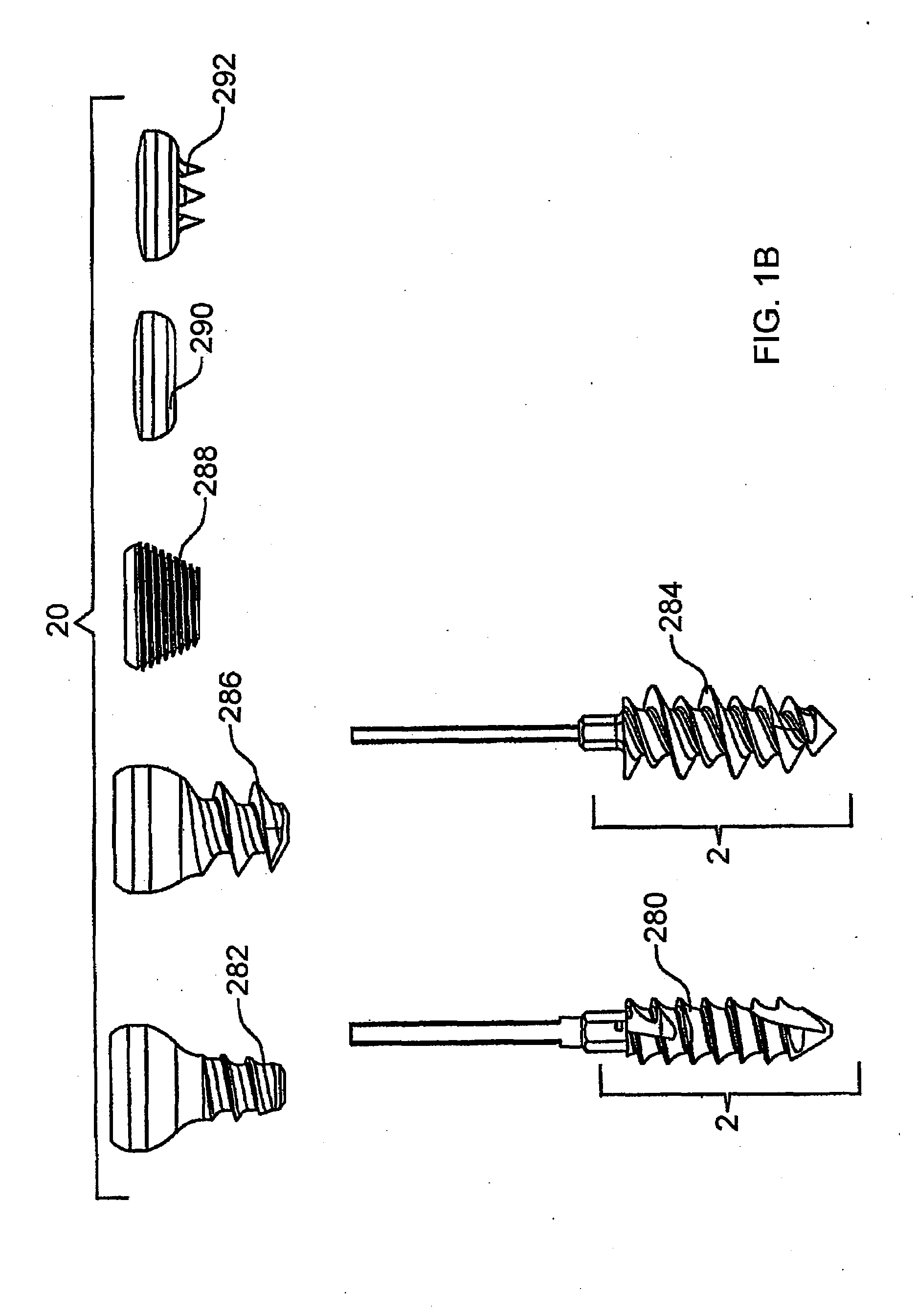 Stabilization system and method for the fixation of bone fractures