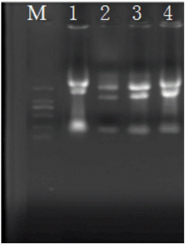 A kind of extraction method of fish oocyte total RNA