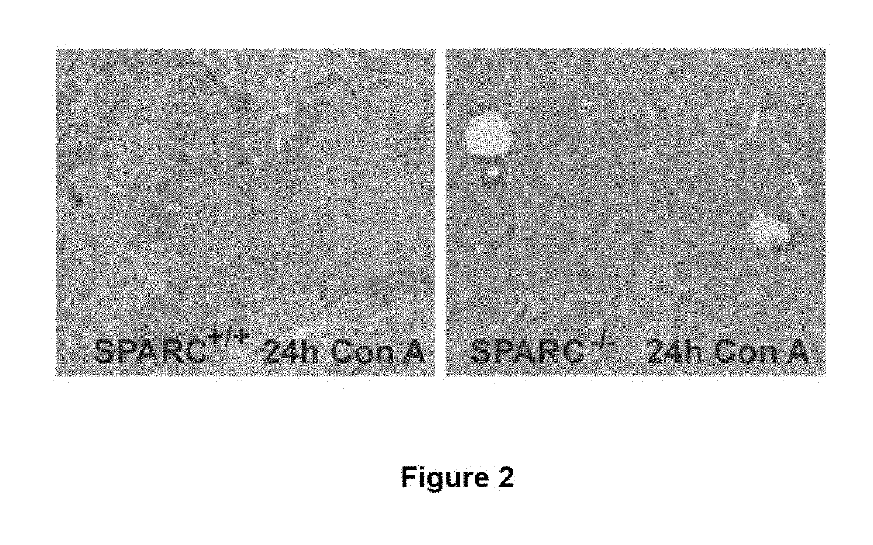 SPARC (secreted protein, acidic and rich in cysteine), a new target for the treatment and prevention of acute liver failure