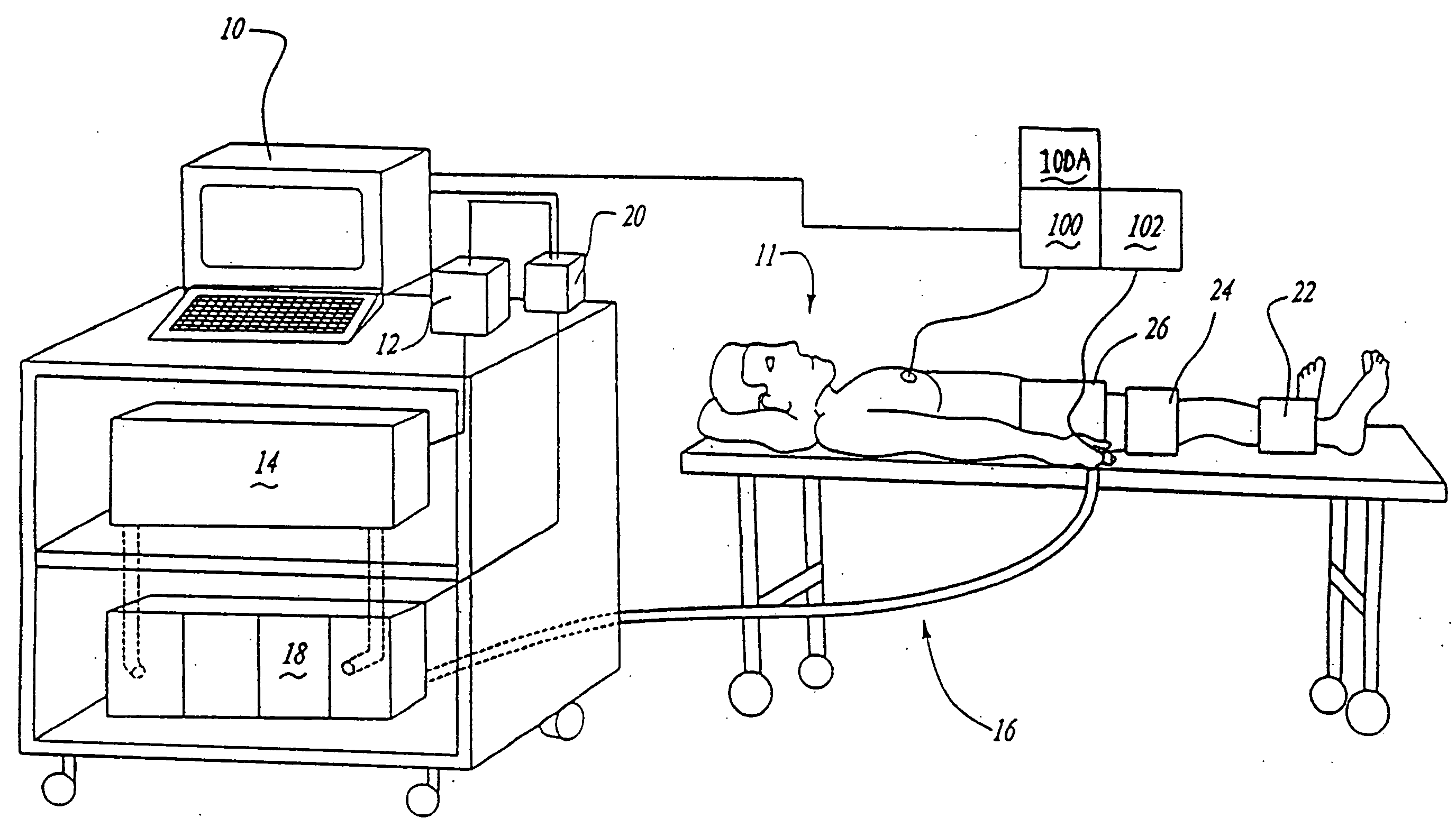 Counterpulsation device using noncompressed air