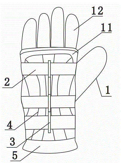 Skiing glove for preventing accident trauma