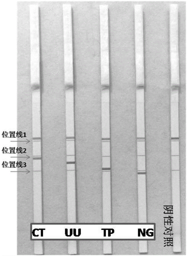 Gonococcus, treponema pallidum, chlamydia trachomatis and ureaplasma urealyticum hybrid membrane strip and detection kit