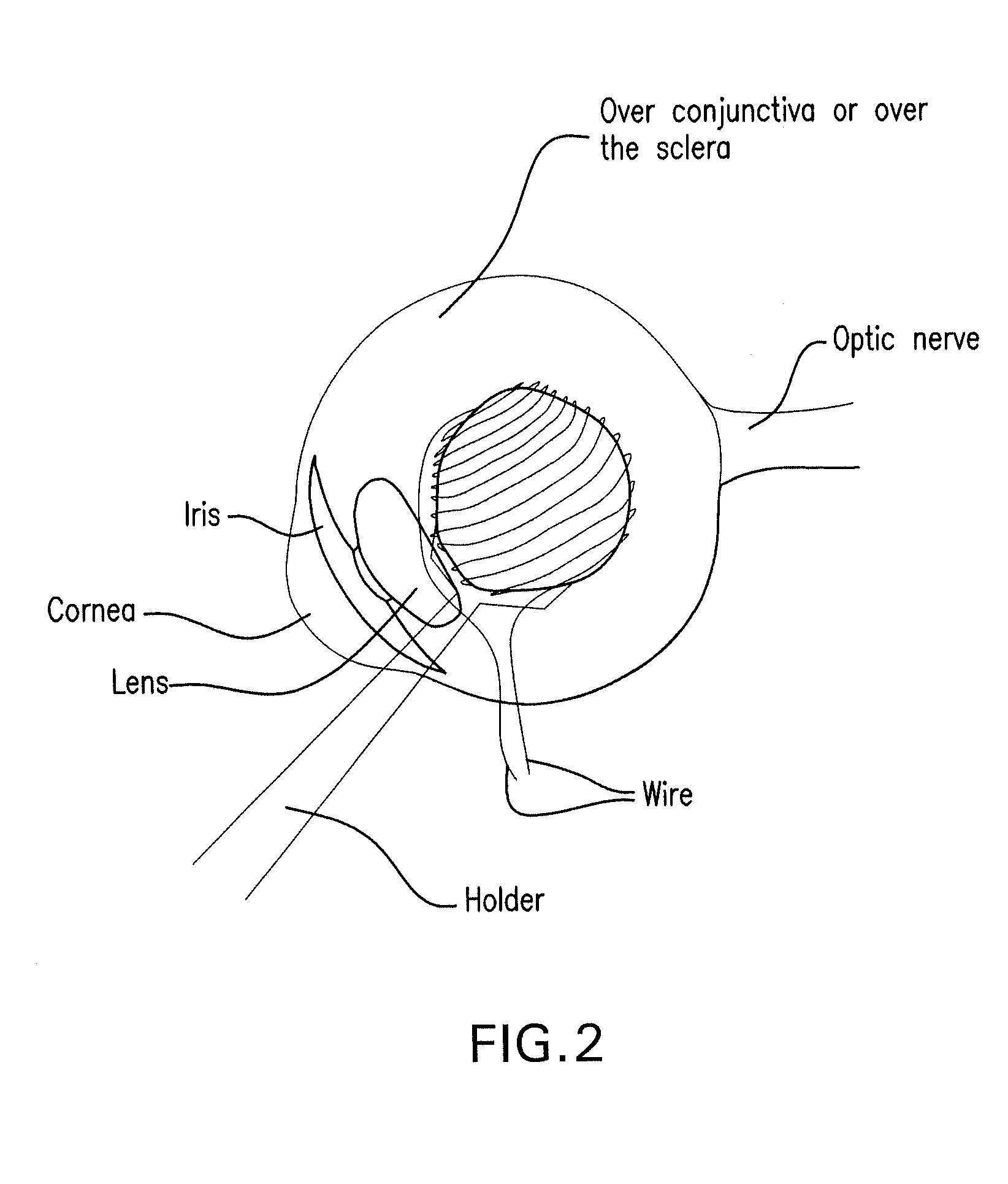 Method and composition for hyperthermally treating cells