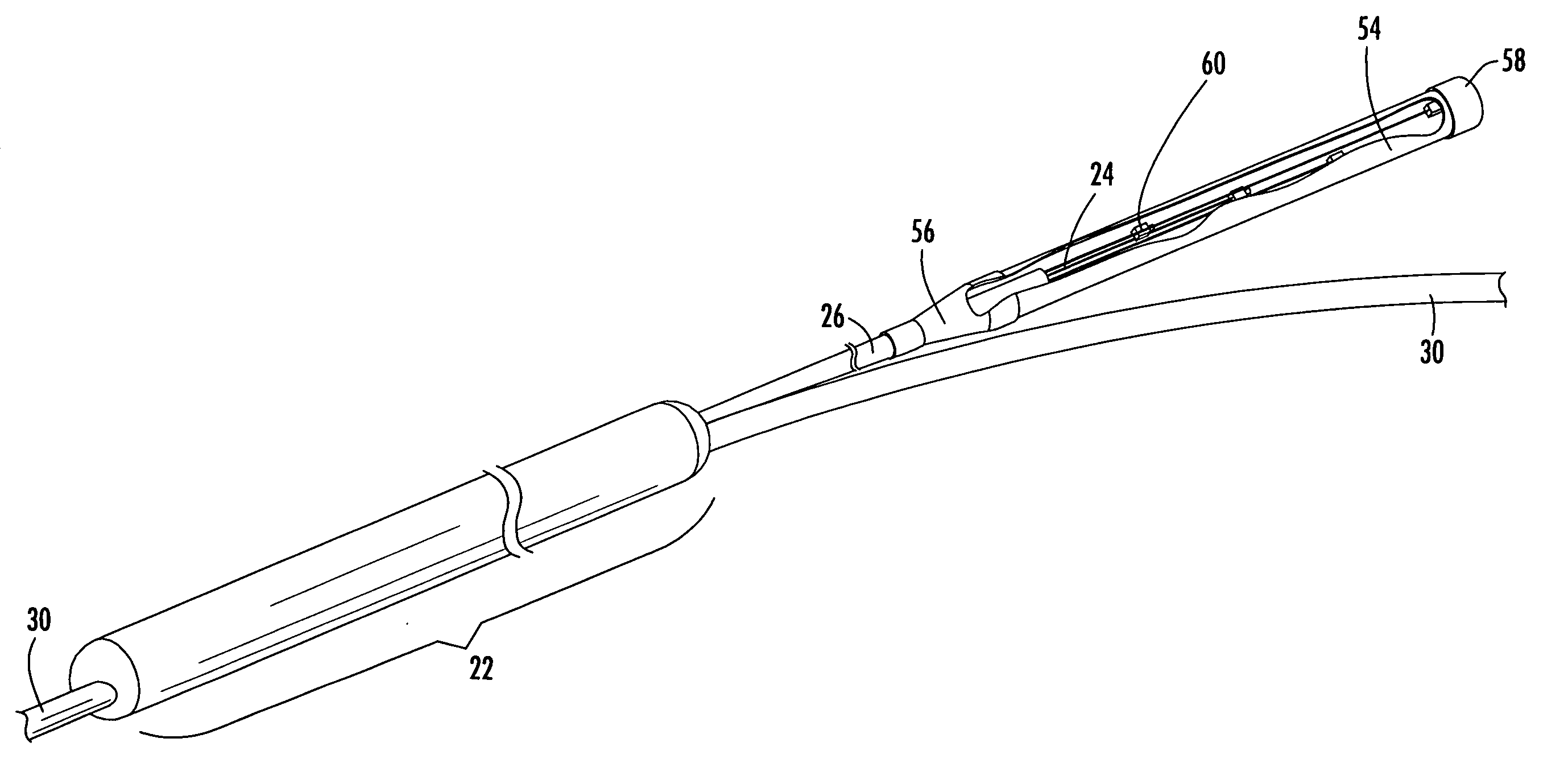 Distribution cable assembly having overmolded mid-span access location
