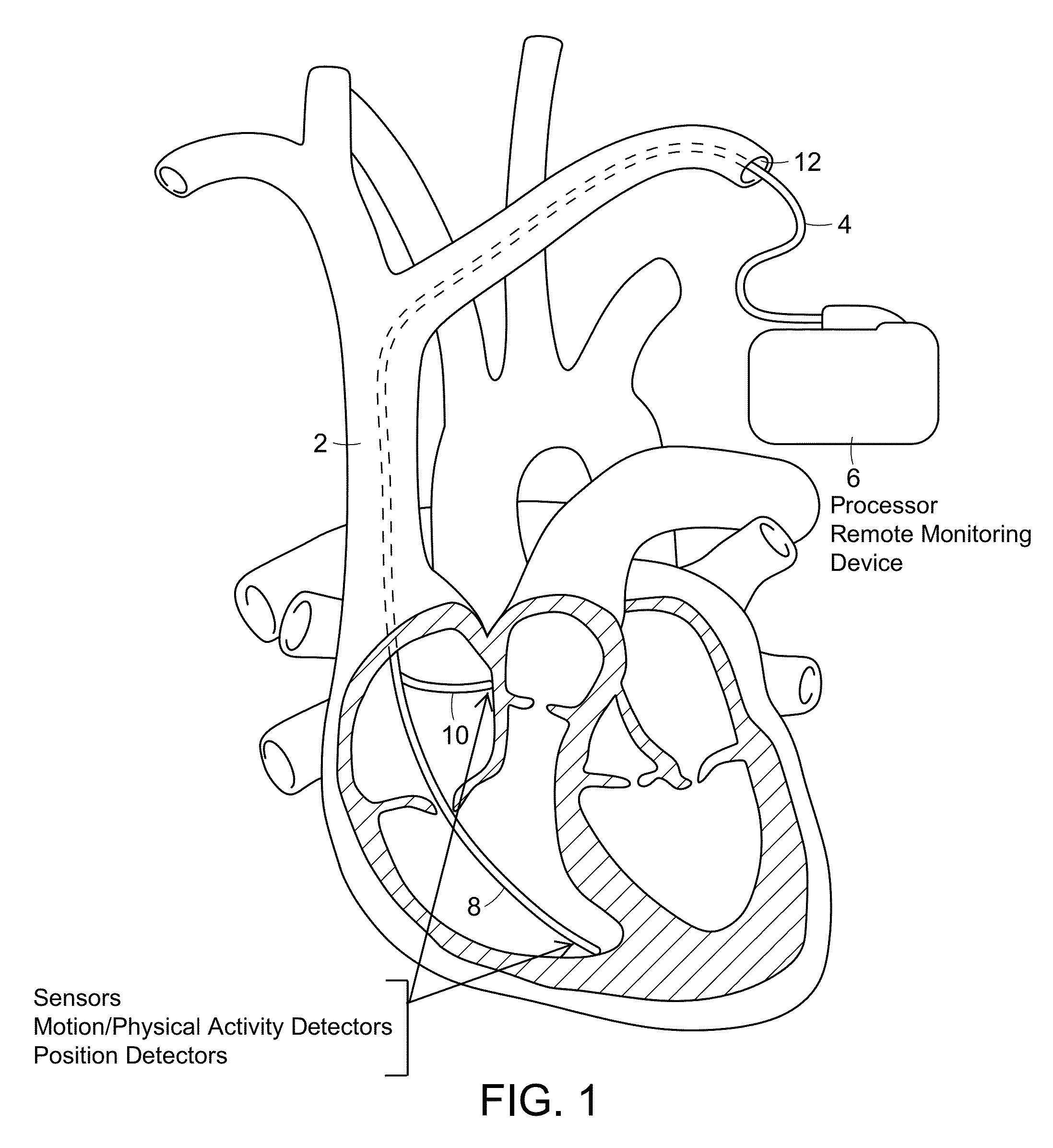 Cardiac pacemaker and uses thereof
