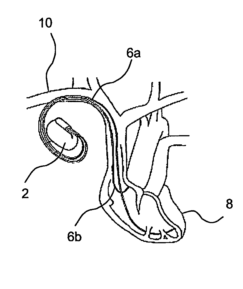 Medical device for determining the posture of patient