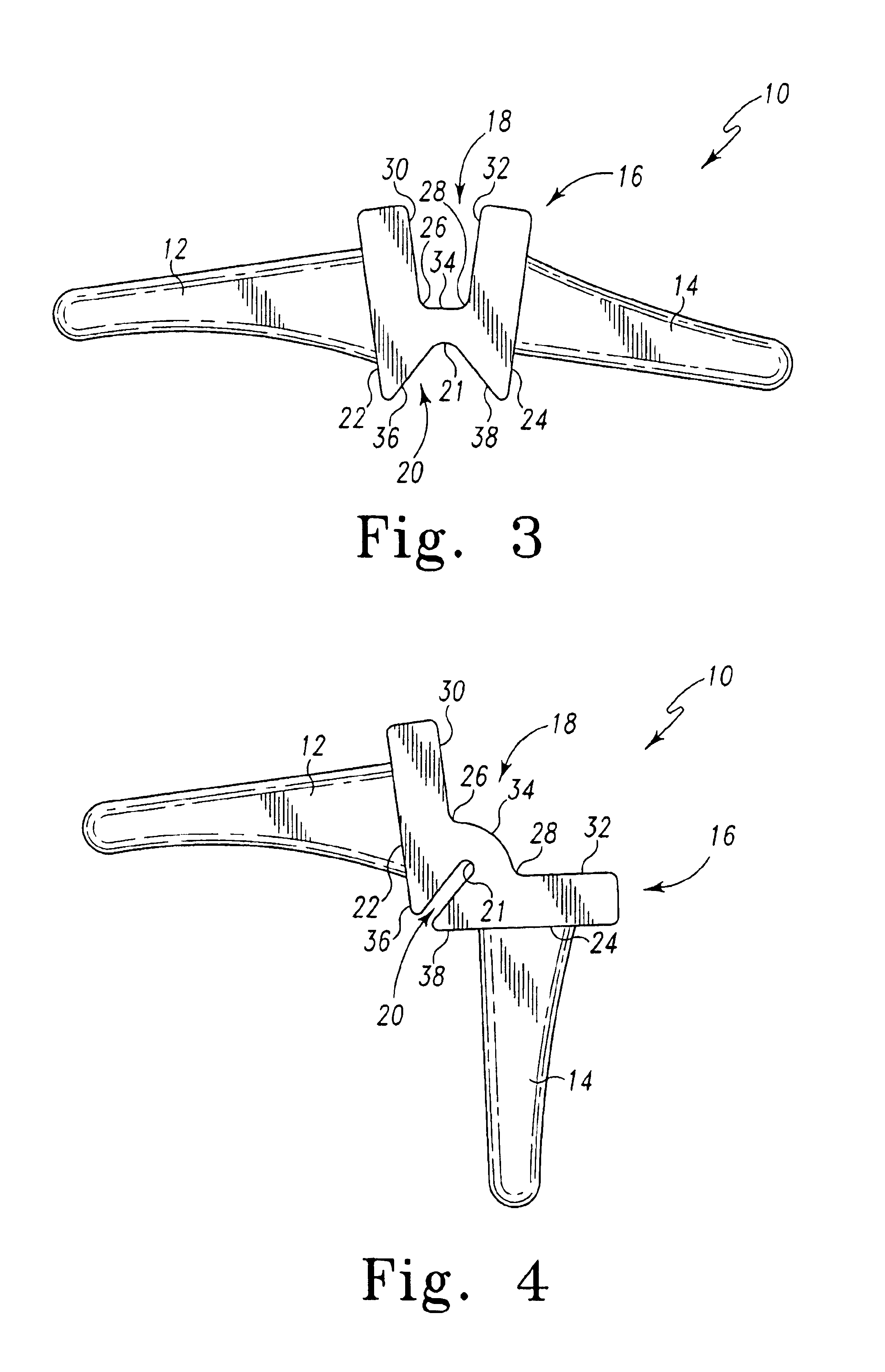 Prosthetic joint component having multiple arcuate bending portions
