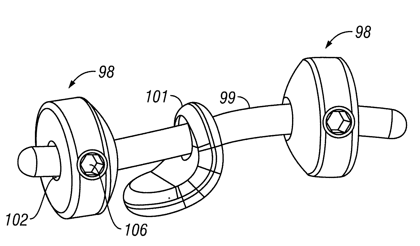 Implant and method for facet immobilization