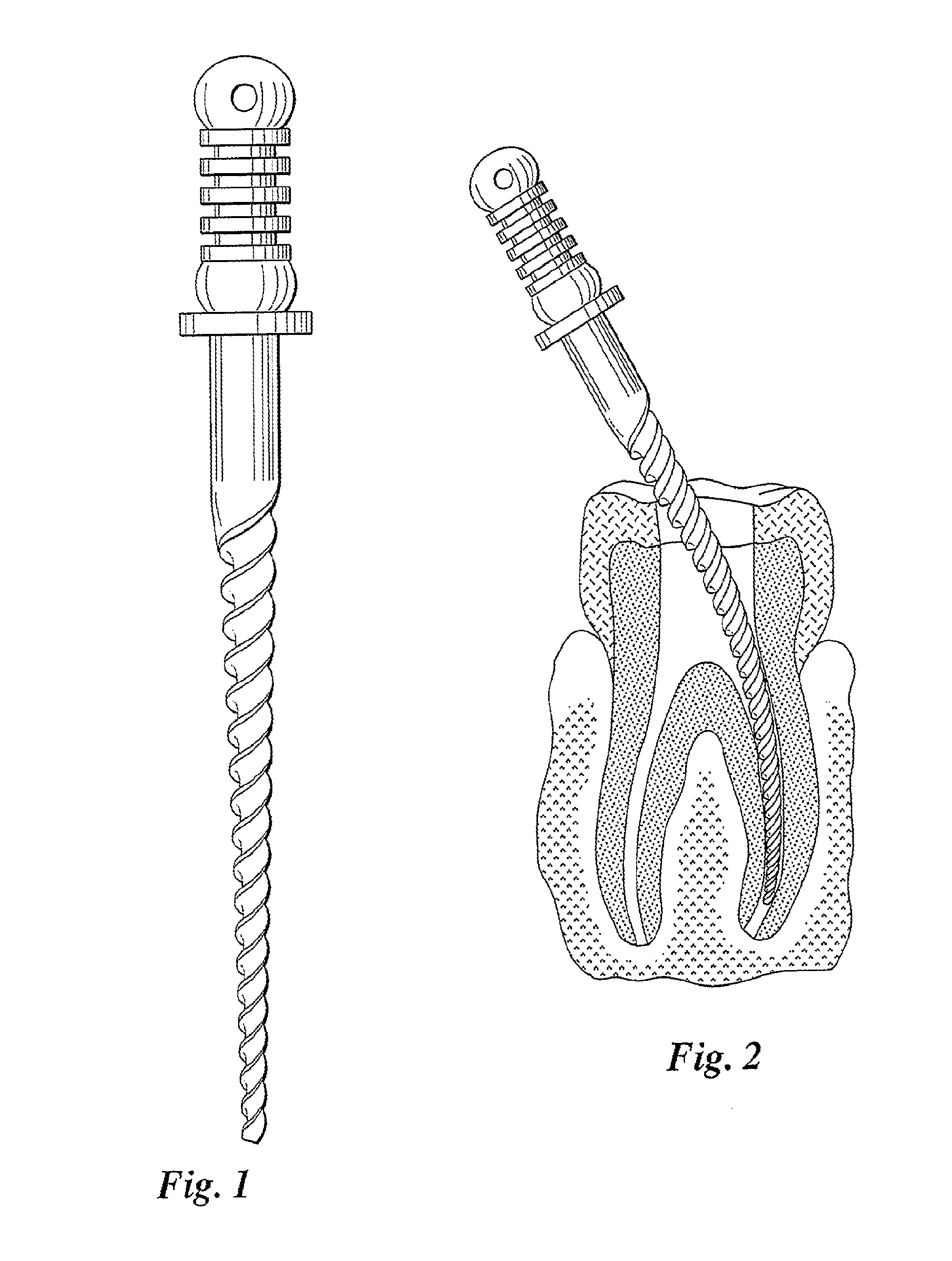 Fatigue-resistant Nitinol instrument