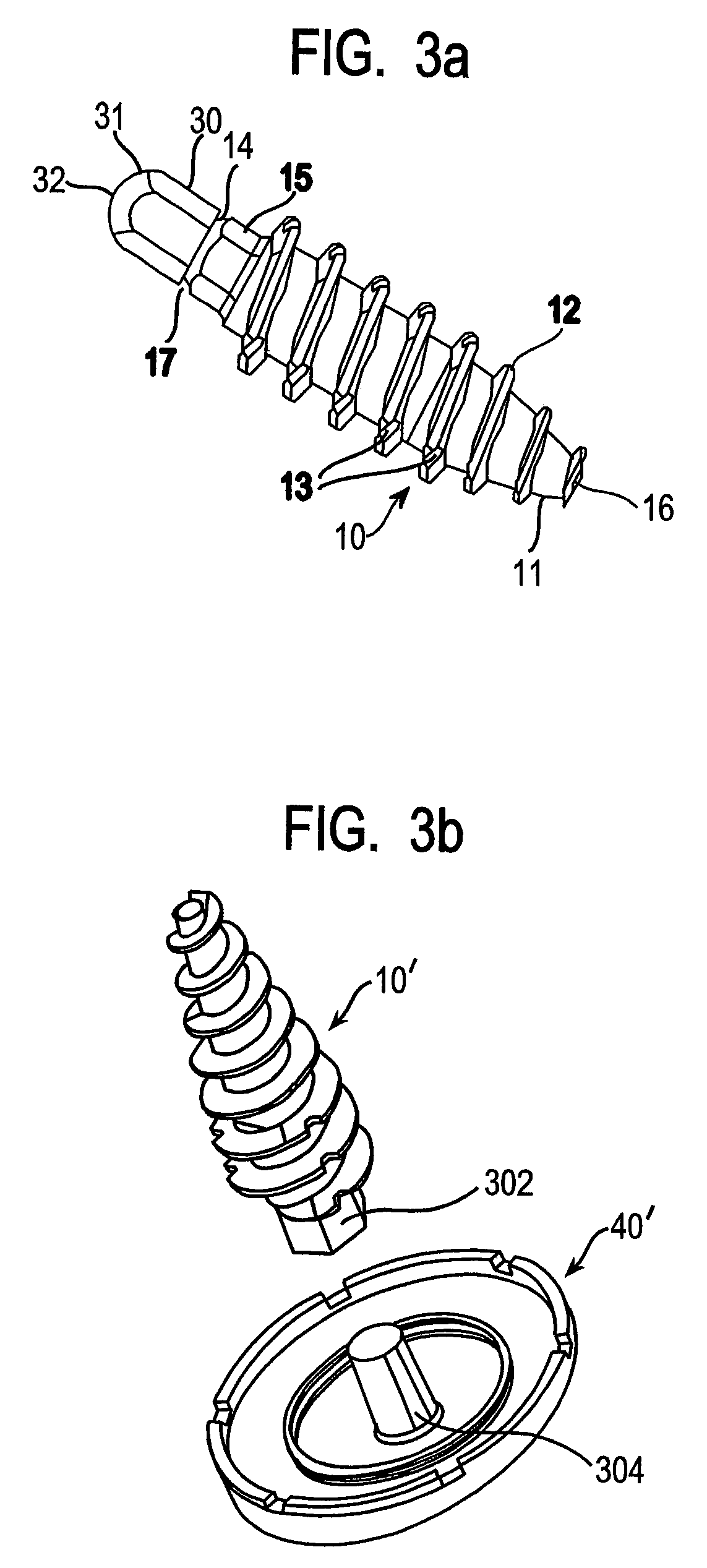 System and method for joint resurface repair