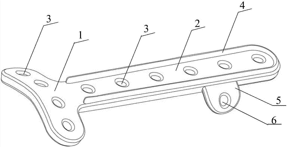 T-shaped/inclined T-shaped degradable pure magnesium distal radius bone plate