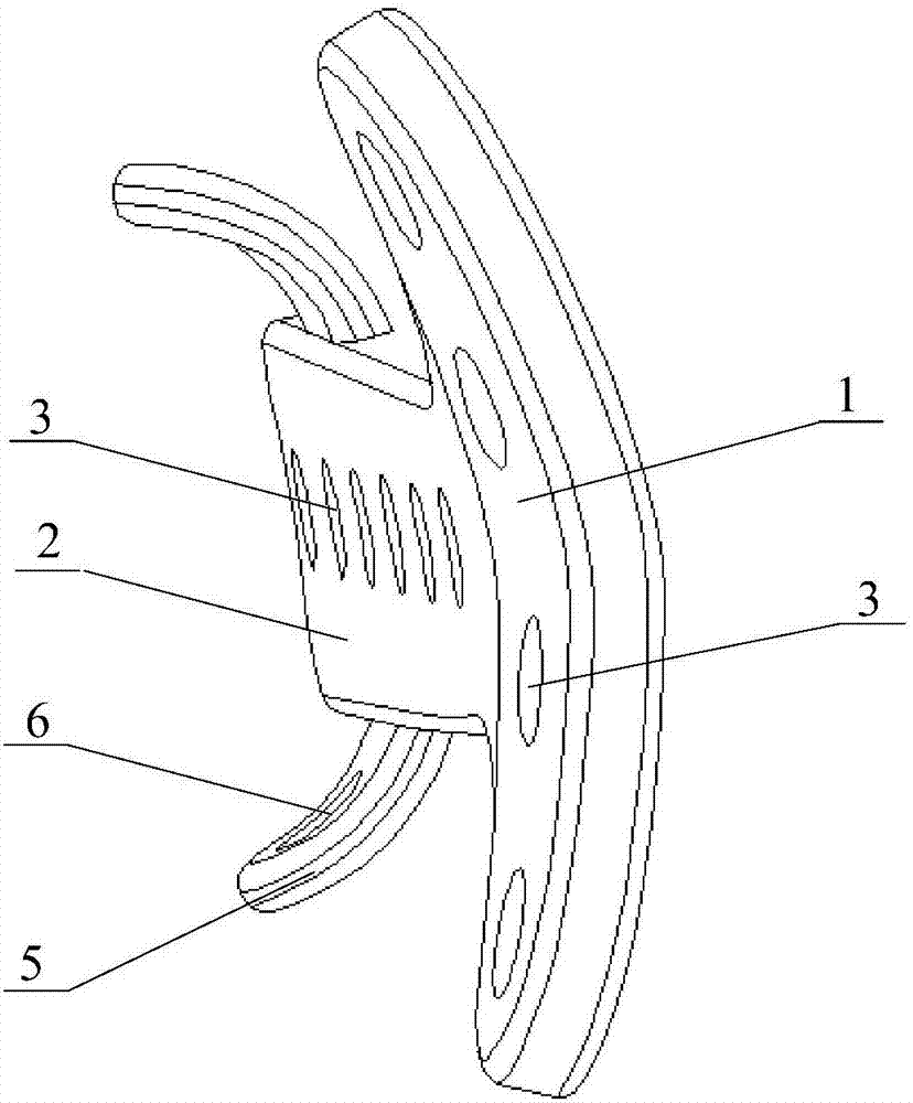 T-shaped/inclined T-shaped degradable pure magnesium distal radius bone plate