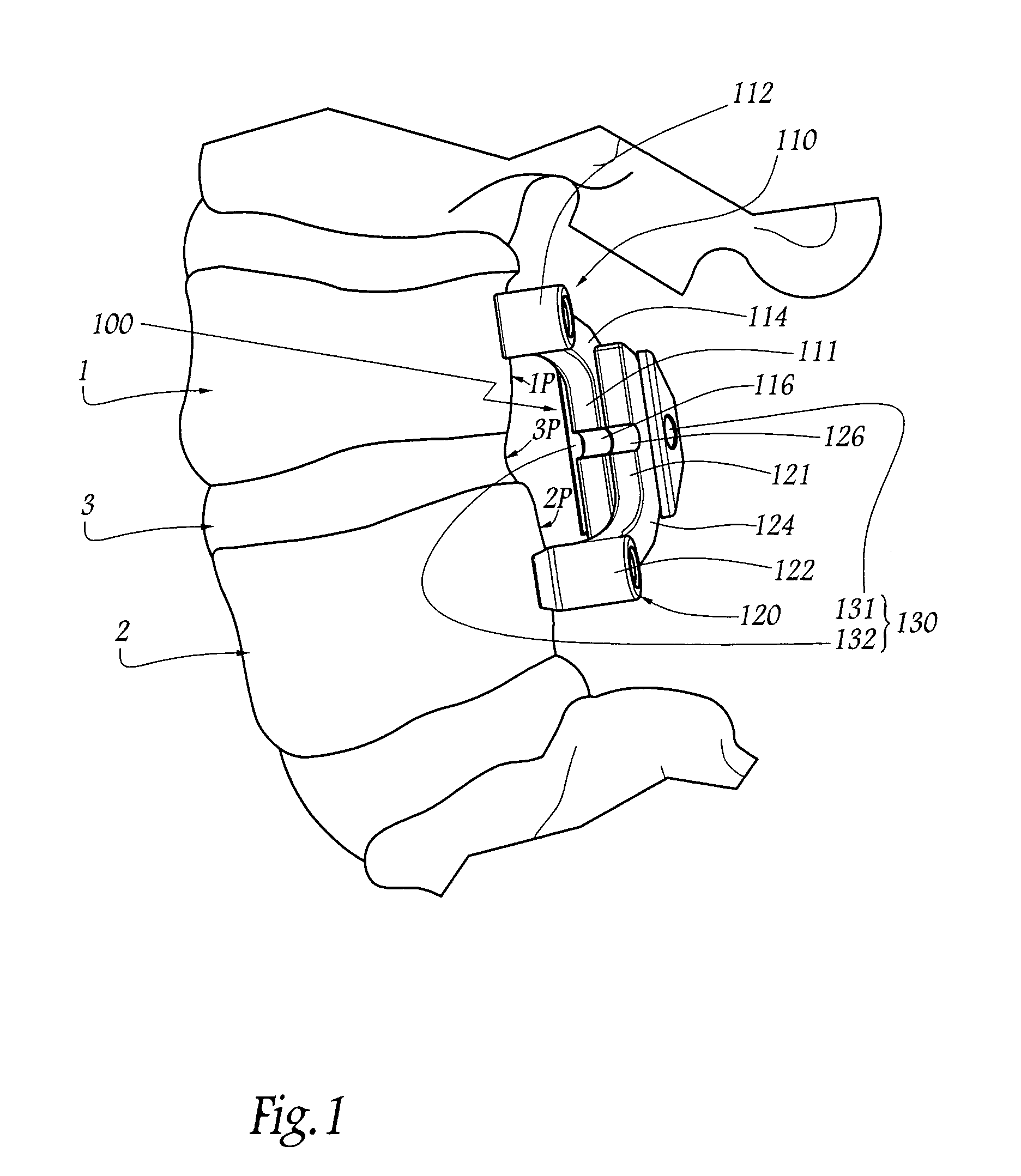 Device and unit for the posterior dynamic guidance of the spine and treatment system comprising such a device