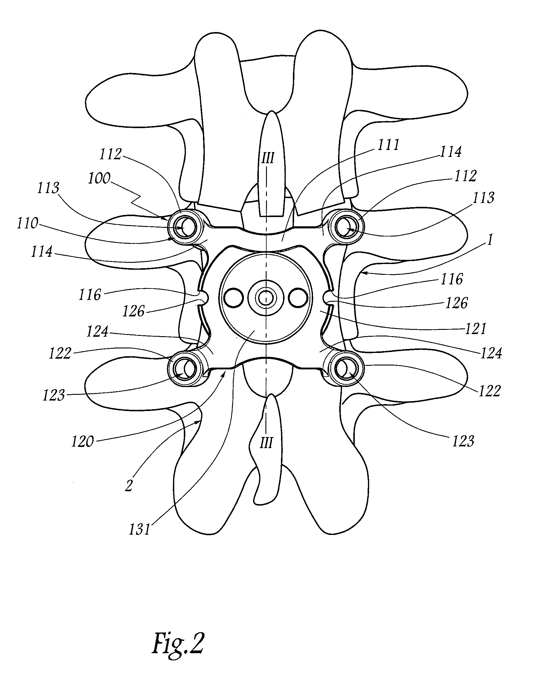 Device and unit for the posterior dynamic guidance of the spine and treatment system comprising such a device